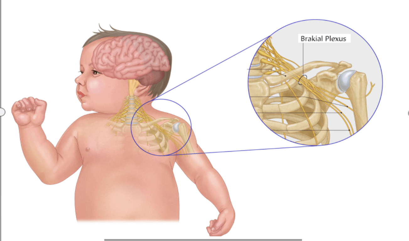 brakial brakial Brakeal Pleksus Bozuklukları