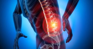 1200x628 Bel Fıtığında Fizik Tedavi