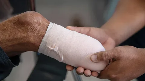 Ampütasyon Sonrası Fizik Tedavi ve Rehabilitasyon FİZİK TEDAVİ İSTANBUL i Ampütasyon Sonrası Fizik Tedavi ve Rehabilitasyon