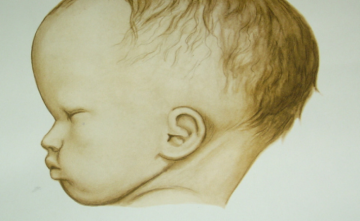 img 16237171451431 1 1024x576 1 Hidrosefali Sonrası Robotik Rehabilitasyonun Önemi