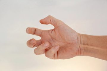 shutterstock 1287093802 Distoni Nedir ve Tedavisi