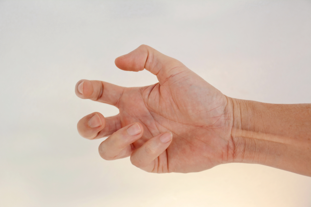 Distoni Tedavisinde Yapılacaklar: Fizyoterapinin Önemi   FİZİK TEDAVİ İSTANBUL shutterstock 1287093802 Distoni Tedavisinde Yapılacaklar: Fizyoterapinin Önemi