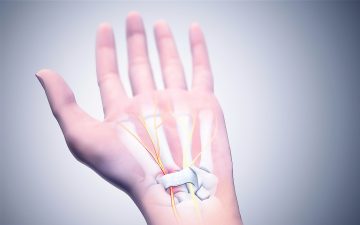 preview Karpal Tünel Sendromu Ve Fizyoterapi