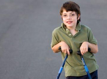 45 Poliomyelit Sekelinde Fizyoterapi ve Rehabilitasyon