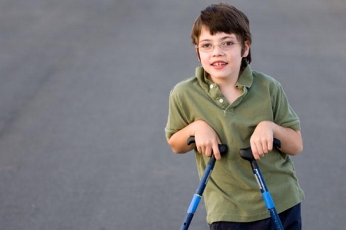 Poliomyelit Sekelinde Fizyoterapi ve Rehabilitasyon