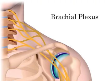 image 20250130112259 1 Brakial Pleksus Fizik Tedavi ile Geçer mi?