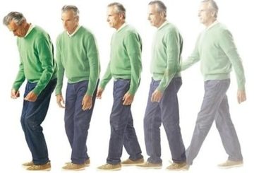 s 0eee3cd89a5bc51ab09e84c3fdcc95ff3ccdb418 Parkinson Hastalarında Denge ve Yürüyüş Eğitiminin Önemi