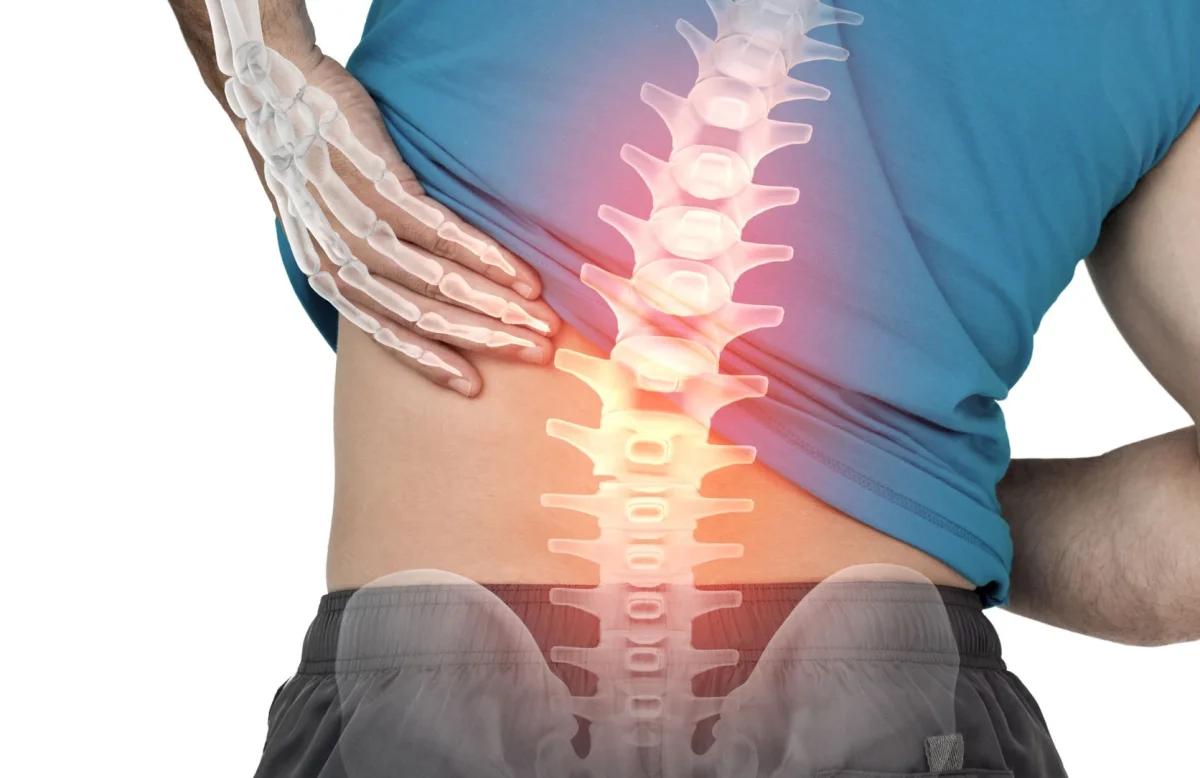 bel fitigi ameliyati Bel Fıtığında Cerrahi Olmadan Hareketin Gücüyle İyileşme