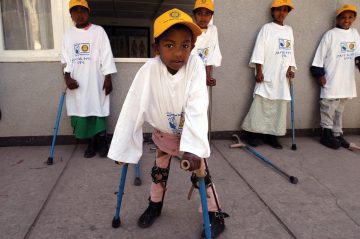 Poliomyelit Sekelinde Fizyoterapi ve Rehabilitasyon FİZİK TEDAVİ İSTANBUL robotik rehabilitasyon merkezi poliomyelit sekelinde fizyoterapi ve rehabilitasyon WKaH1JWeei Poliomyelit Sekelinde Fizyoterapi ve Rehabilitasyon